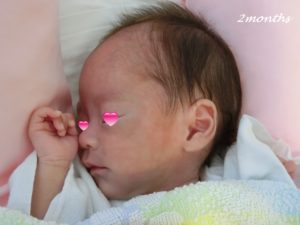 未熟児ちゃんの頭の形が気になる おでこが広い 3年間を振り返り リトベビ 28週超低体重児を早産したママのブログ